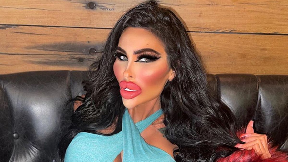 Tara Jayne McConachy wydała fortunę na operacje plastyczne