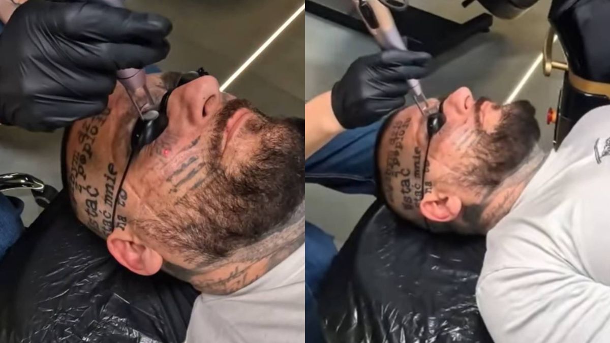 Popek usuwa tatuaże