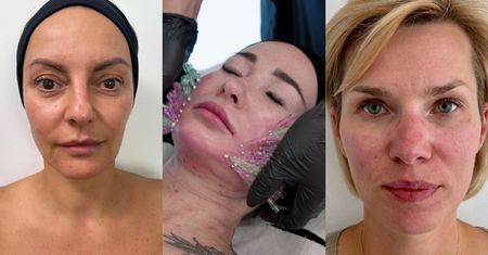 "Młodość na zamówienie". Zobaczcie, jak zmieniły się bohaterki po zabiegach w MOBILNEJ KLINICE medycyny estetycznej (ZDJĘCIA)