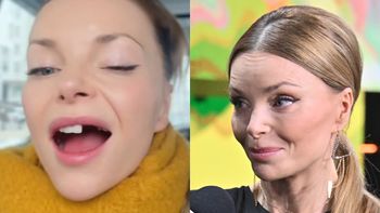 Dumna Izabella Miko prezentuje BRAKI W UZĘBIENIU: "Będę się bawić moim nowym lookiem" (FOTO)