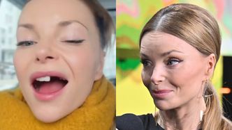 Dumna Izabella Miko prezentuje BRAKI W UZĘBIENIU: "Będę się bawić moim nowym lookiem" (FOTO)