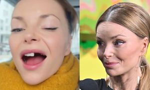 Dumna Izabella Miko prezentuje BRAKI W UZĘBIENIU: "Będę się bawić moim nowym lookiem" (FOTO)