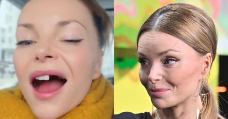 Dumna Izabella Miko prezentuje BRAKI W UZĘBIENIU: "Będę się bawić moim nowym lookiem" (FOTO)