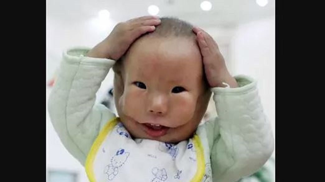 Urodził się ze zdeformowaną twarzą. Ludzie wyśmiewali go i przezywali Mask Boy