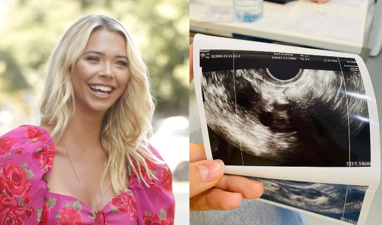 Sandra Kubicka pokazała USG jajników