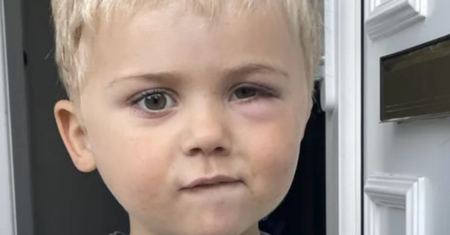 Lekarze myśleli, że to alergia. Trzylatek był bliski śmierci