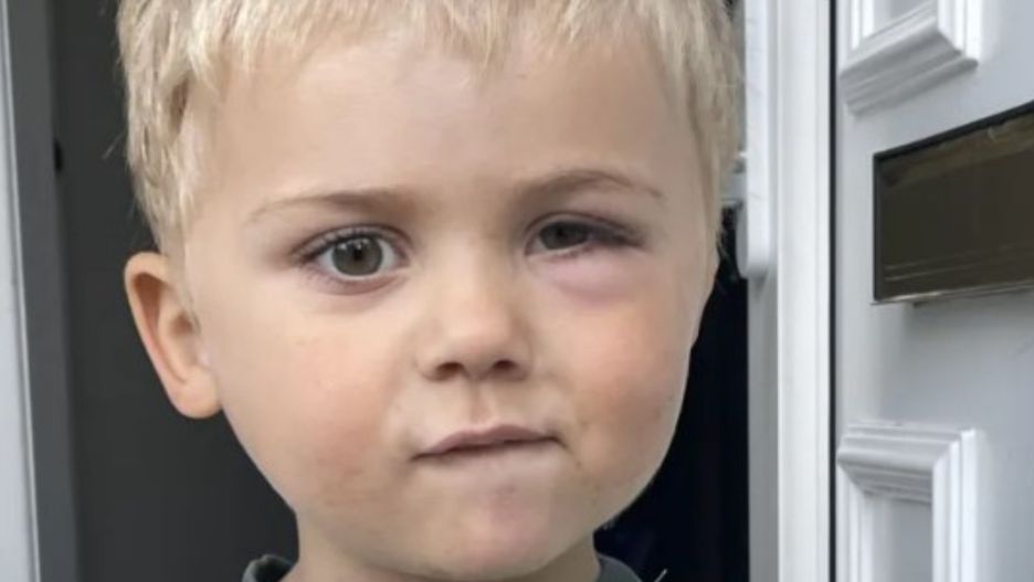 U chłopca zdiagnozowano rzadki nowotwór