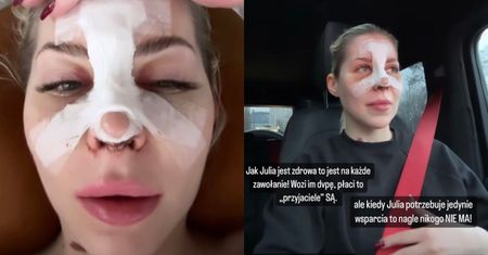 DRAMAT Julii von Stein! Przyjaciele PORZUCILI JĄ po operacji nosa: "Na nikogo nie można liczyć..."