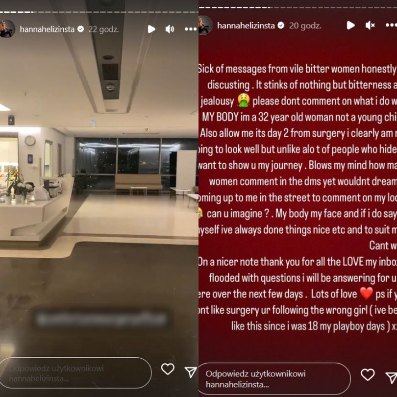 Uczestniczka brytyjskiego "Love Island" chwali się efektami operacji w tureckiej klinice