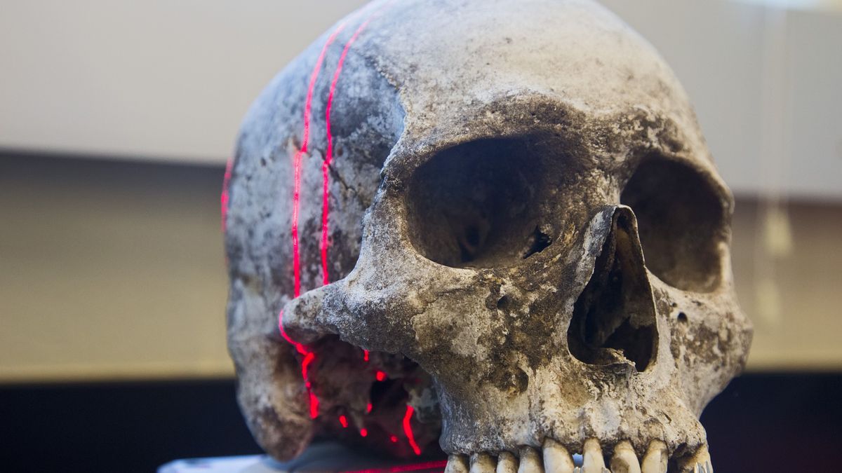 Waco, Texas, A scanner makes a 3D photograph of the skull of an unidentified migrant who died trying to enter the United States without legal documents. Dr. Lori Baker and her students at Baylor University are working to identify many such corpses. Most perished in a long, hot walk as they tried to evade a Border Patrol checkpoint 70 miles north of the border. (Photo by: Jim West/UCG/Universal Images Group via Getty Images)