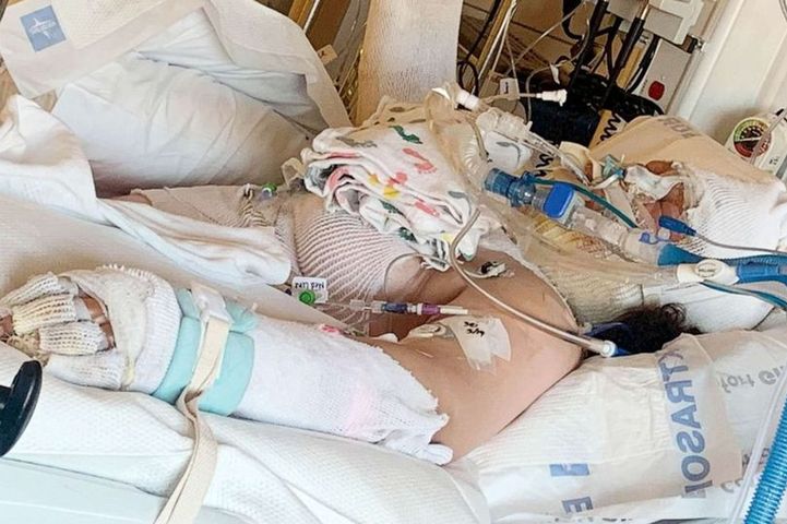 Niebezpieczne wyzwanie na TikToku. 13-latka z poparzeniami trzeciego stopnia trafiła do szpitala