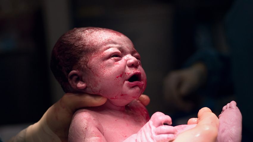 Naturalna cesarka – alternatywa dla porodu naturalnego?