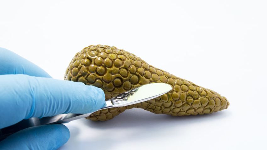 CA 19-9 to antygen towarzyszący nowotworom przewodu pokarmowego