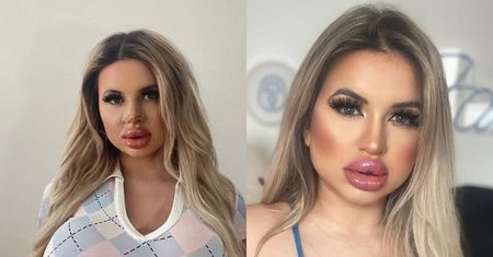 Zmieniła się w "ludzką Barbie". Niewiarygodne, ile za to zapłaciła