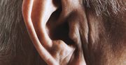 Wyraźny objaw miażdżycy. Zauważysz na uchu
