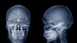 Czaszka - budowa, ciemiączko