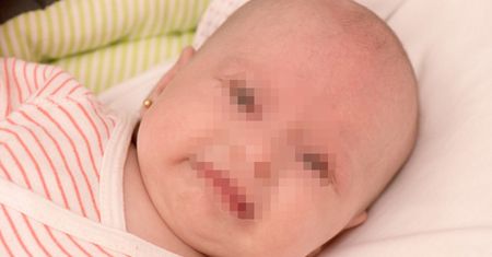 W takim stanie wróciła od babci. Matka dziewczynki jest wściekła