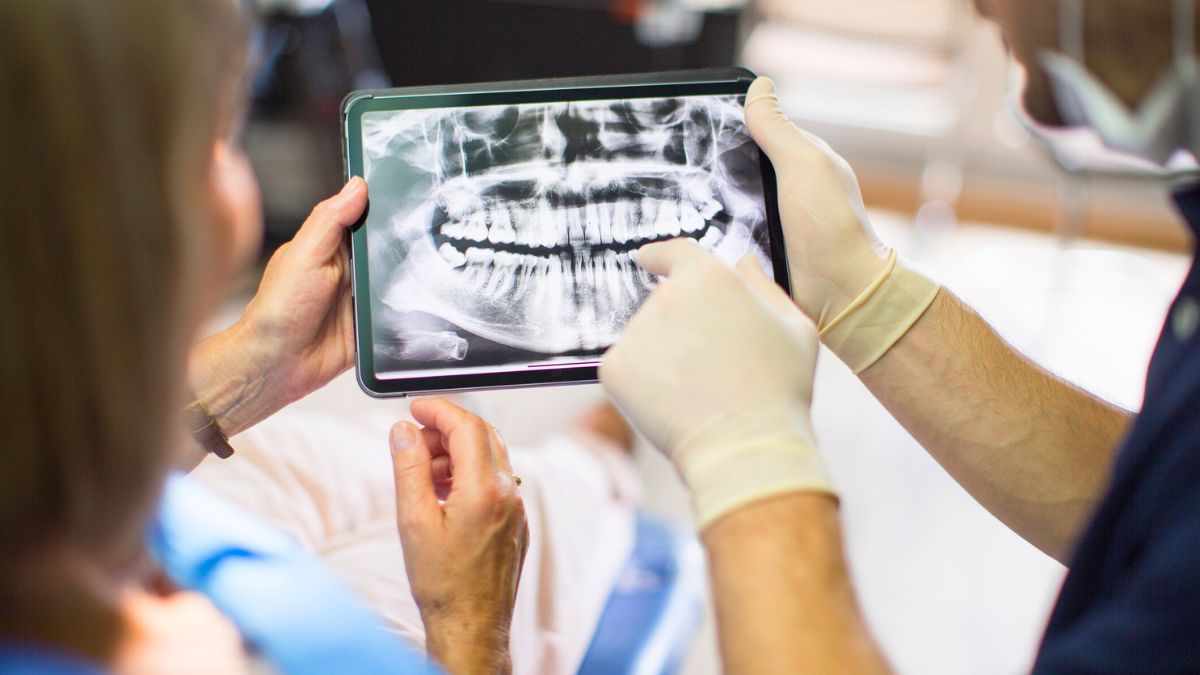 Dentyści oglądają rentgen zębów 