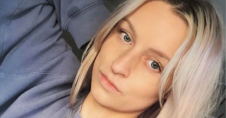Megan Crome leczyła się popularnymi maściami. Skutki były opłakane