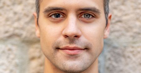 Heterochromia - co to jest i czy może być niebezpieczna?