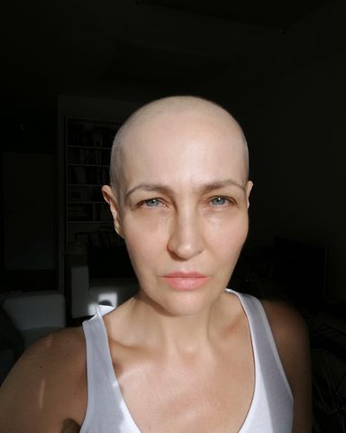 Anna Puślecka cierpi na złośliwy nowotwór piersi.