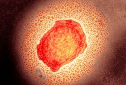 Pierwszy przypadek małpiej ospy u naszych sąsiadów