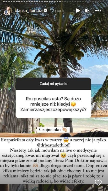 Blanka Lipińska rozpuściła sobie kwas w twarzy