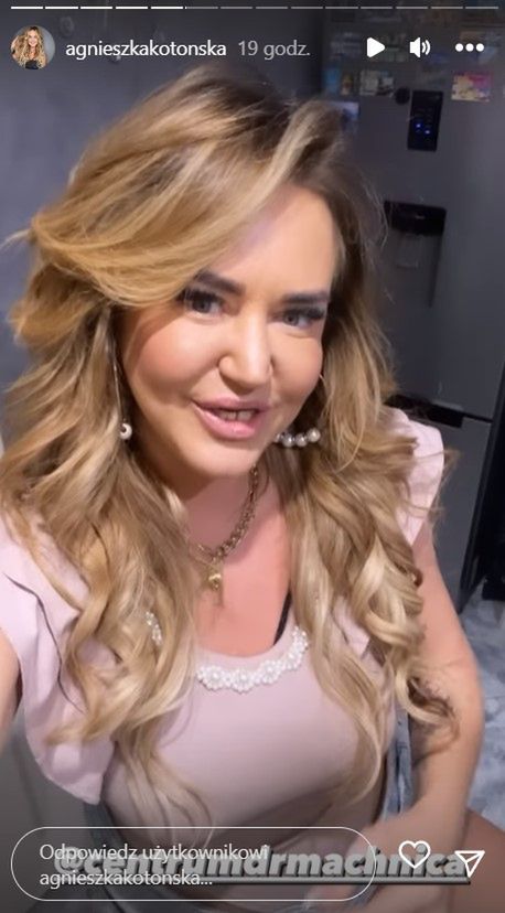Agnieszka Kotońska pokazała twarz po zabiegu