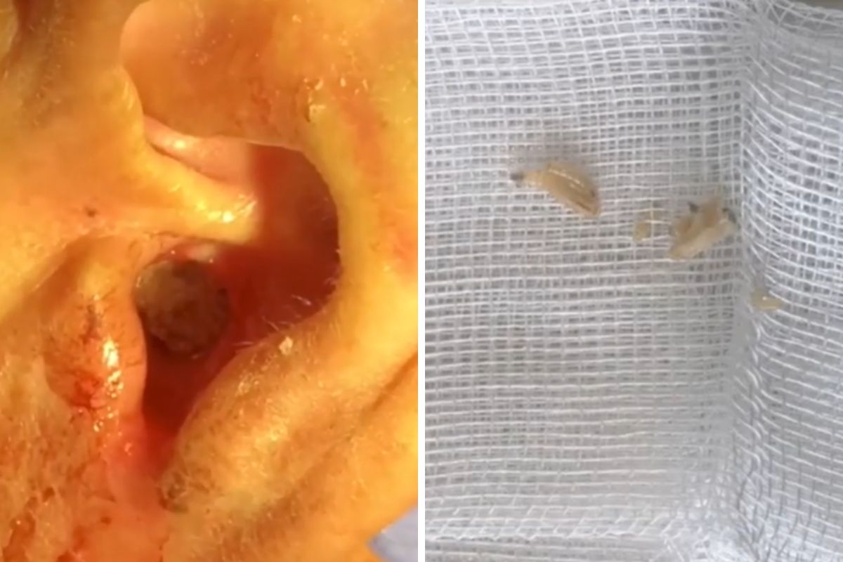 W jego uchu zagnieździły się larwy