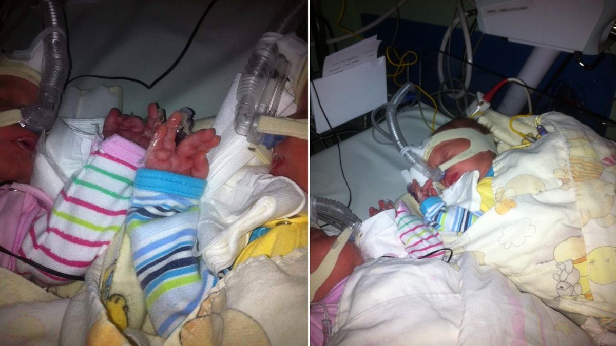 Wcześniaki wymagają kompleksowej opieki, innej niż donoszone noworodki 