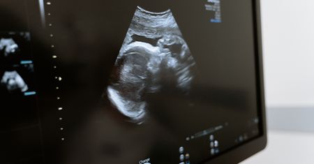 Aborcja w Polsce. Ministerstwo Zdrowia ujawniło dane