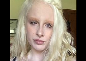 Jest albinoską. Internet oszalał na jej punkcie. "Wygląda jak anioł" 