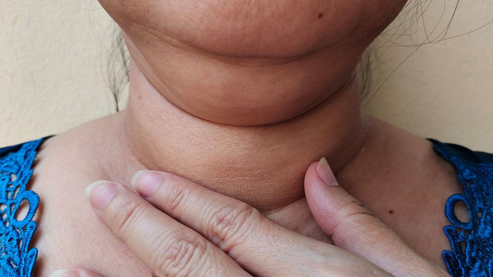 Czy można mieć guzy tarczycy przy prawidłowym TSH?