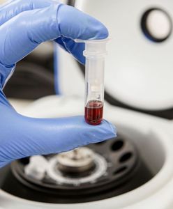 Warszawa. "Królewski dar". Akcja krwiodawstwa w parku Łazienki Królewskie