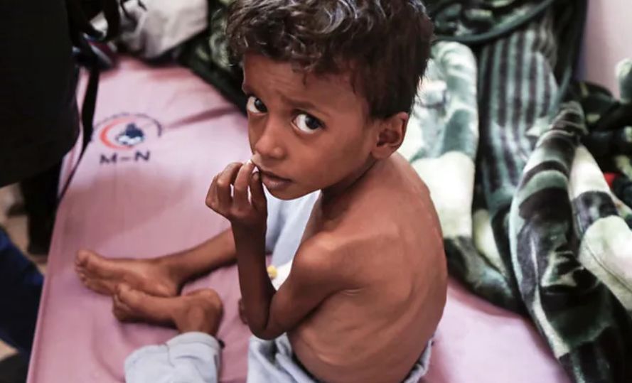 Klęska głodu w Jemenie