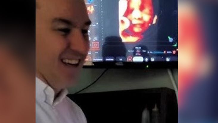 Niezwykła reakcja malucha na USG. Internauci są zachwyceni