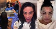 U Katie Price bez zmian. Pokazała twarz całą w opatrunkach, relacjonując kolejną operację w tureckiej klinice