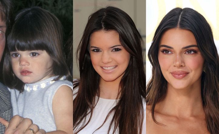 Kendall Jenner kończy 28 lat! Modelkę podejrzewa się o WIELE ingerencji w urodę. Zobaczcie, jak zmieniała się na przestrzeni lat (ZDJĘCIA)