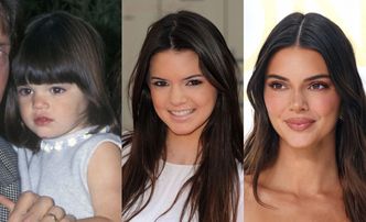 Kendall Jenner kończy 28 lat! Modelkę podejrzewa się o WIELE ingerencji w urodę. Zobaczcie, jak zmieniała się na przestrzeni lat (ZDJĘCIA)
