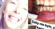 Ewa Chodakowska pochwaliła się na Instagramie... wizytą u dentysty