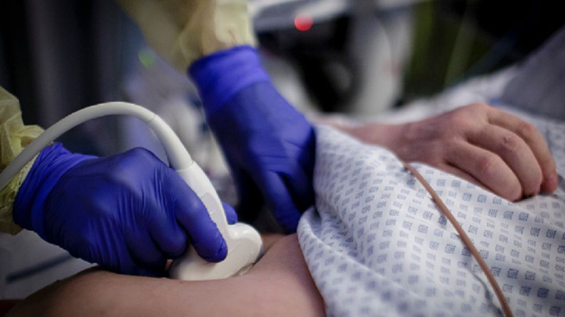 BAD BELZIG, GERMANY - July 30: A medical  doctor does an ultrasound examination at a patient in an intensive care unit on July 30, 2018 in Bad Belzig, Germany. (Photo by Inga Kjer/Photothek via Getty Images)
Inga Kjer