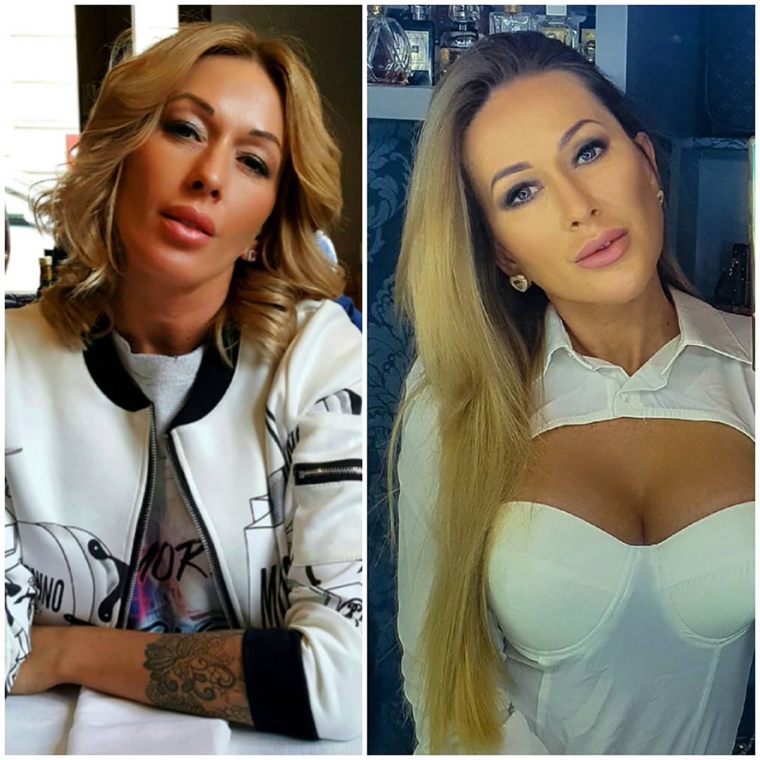 Sylwia Peretti o medycynie estetycznej