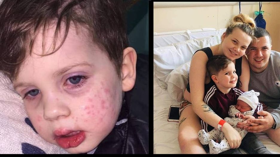 3-latek zachorował po kontakcie z wirusem opryszczki. Zagrożone było też życie i zdrowie nienarodzonego jeszcze dziecka