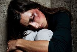 Przemoc domową mogą wykrywać ortopedzi