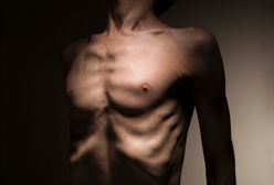 Anoreksja wśród mężczyzn – nowe oblicze znanej choroby