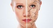 Jak walczyć ze zmarszczkami?