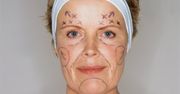 Mamuśki pod nóż - po co nam operacje plastyczne?