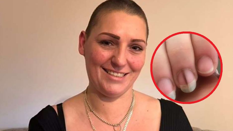 Nowotwór skóry może dawać nietypowe objawy