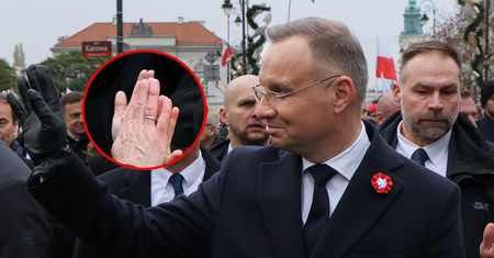 Media pokazały zdjęcie. Tak wygląda ręka Dudy bez opatrunku