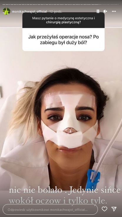 Monika Chwajoł pokazała stare zdjęcia i opowiedziała o operacjach